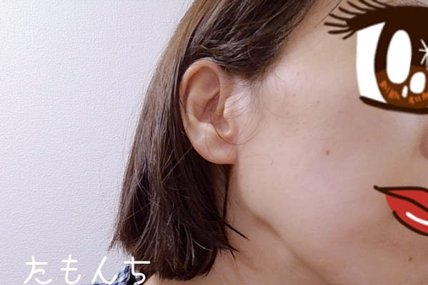 私の頬周りの写真